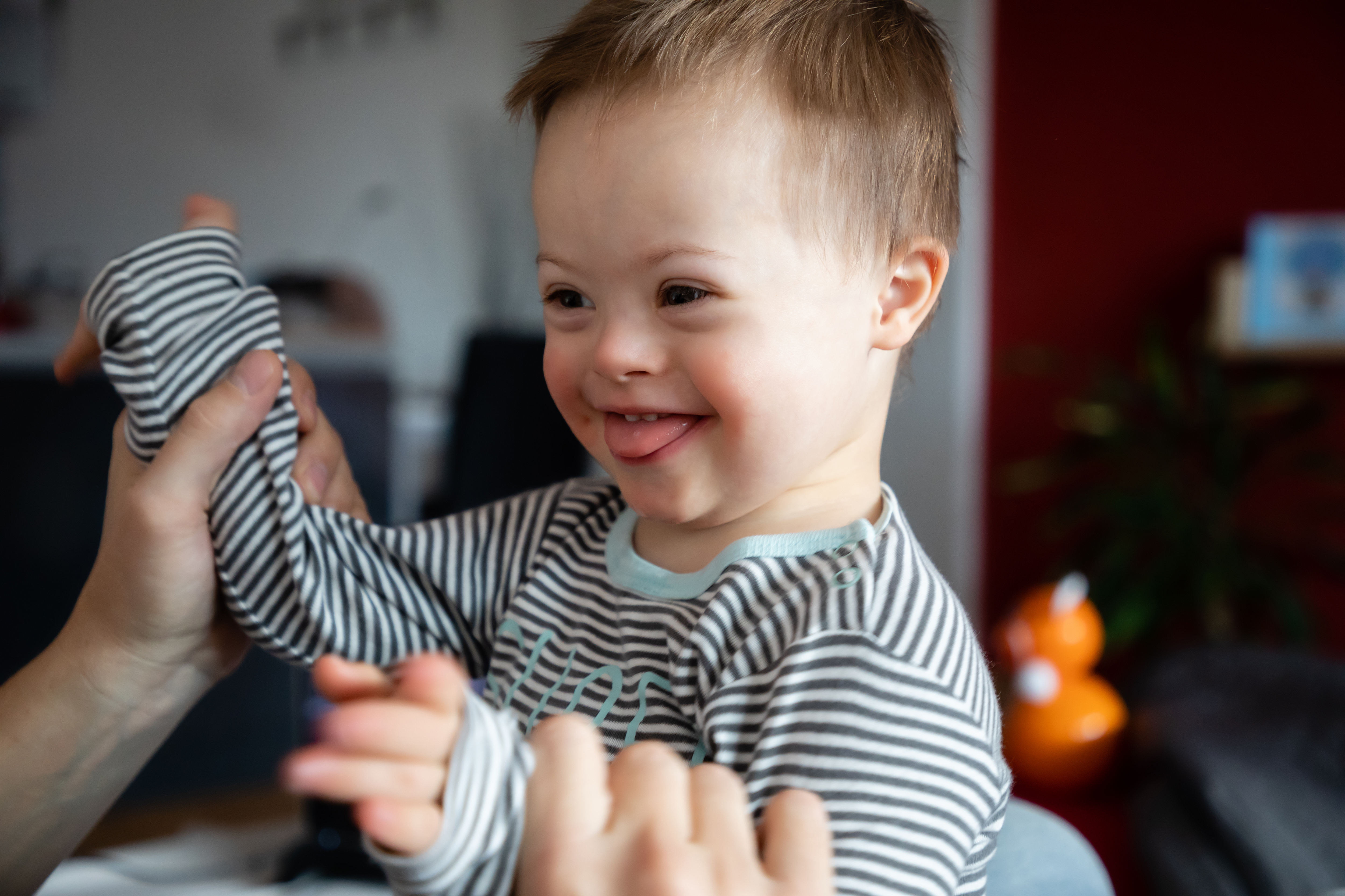 An image of a young child with down syndrome